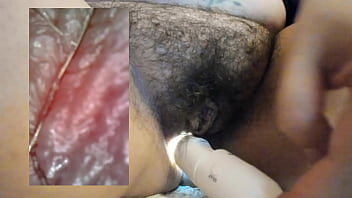 Meraviglioso video di endoscopia vaginale vore - Video completo di 45 minuti su Xred