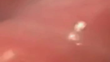 Meraviglioso video di endoscopia vaginale vore - Video completo di 45 minuti su Xred