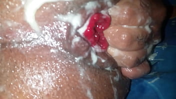 Self Anal fisting huge gapes anal creampie