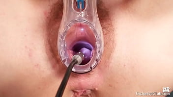 Olga Barz gynecological examination