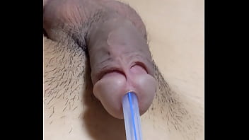 尿道バルーンカテーテルの除去。カテの先端にある一回り太くなったバルーン機構が、前立腺を通過した瞬間ゴリュゴリュッ！と擦られて強烈な快感が&hellip_