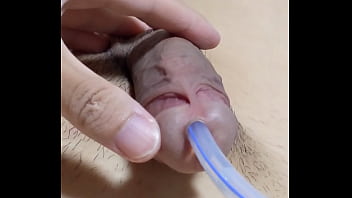 尿道バルーンカテーテルの除去。カテの先端にある一回り太くなったバルーン機構が、前立腺を通過した瞬間ゴリュゴリュッ！と擦られて強烈な快感が&hellip_