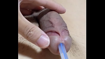 尿道バルーンカテーテルの除去。カテの先端にある一回り太くなったバルーン機構が、前立腺を通過した瞬間ゴリュゴリュッ！と擦られて強烈な快感が&hellip_