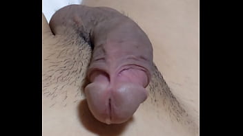 尿道バルーンカテーテルの除去。カテの先端にある一回り太くなったバルーン機構が、前立腺を通過した瞬間ゴリュゴリュッ！と擦られて強烈な快感が&hellip_