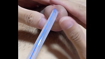 尿道バルーンカテーテルの除去。カテの先端にある一回り太くなったバルーン機構が、前立腺を通過した瞬間ゴリュゴリュッ！と擦られて強烈な快感が&hellip_