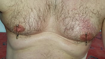 Foley catheter and safety-pins extraction