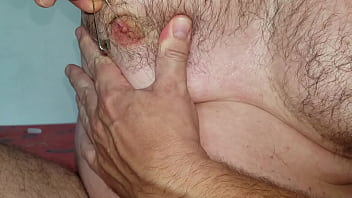 Foley catheter and safety-pins extraction