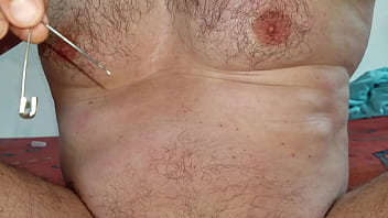 Foley catheter and safety-pins extraction