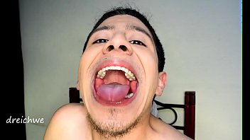 Opening the mouth with a big tongue