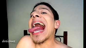 Opening the mouth with a big tongue