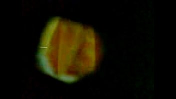 Pine hole on swimmin pool (Coming hend)