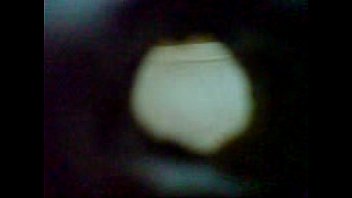 Pine hole on swimmin pool (Coming hend)