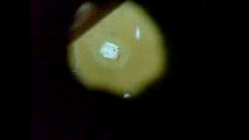 Pine hole on swimmin pool (Coming hend)