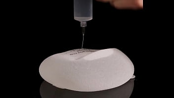 Making of fake tits: filling of expander silicone breast implant with saline into twice its prescribed size