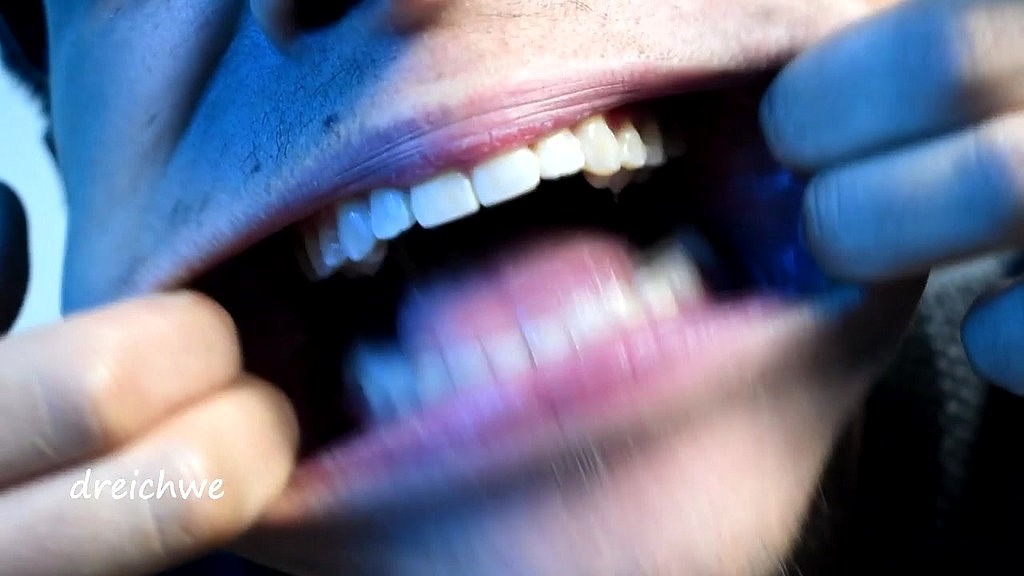 opening my mouth for all