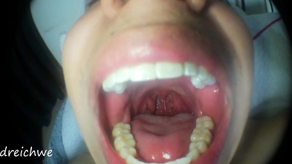 mouth fetish - collection 25