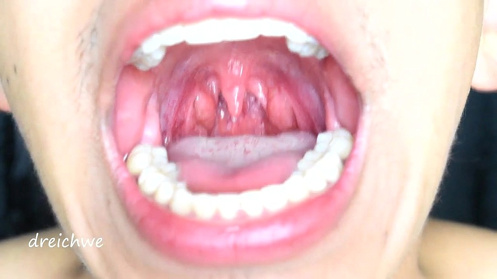 exciting uvula