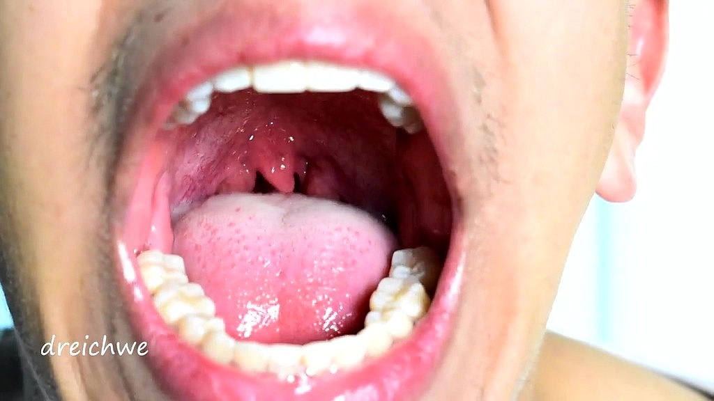 deep and exciting uvula