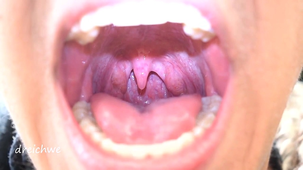 uvula fetish