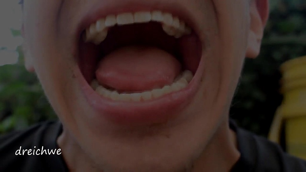 chocolate on the teeth