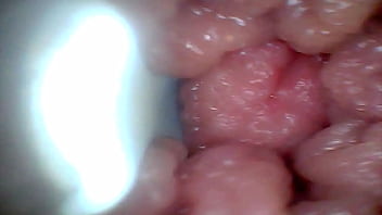 Endoscope camera shows the most sensitive parts of the penis Educational video