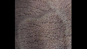 O QUE SÃ_O ESSAS MANCHAS EM MEU PENIS? UM CLOSE BEM DE PERTO