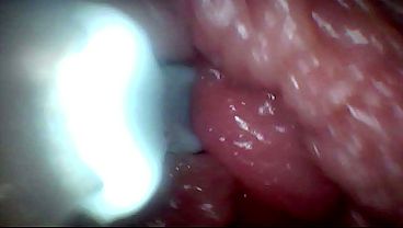 Extreme Proximity Turns Watcher Into Active, Hungry Participant